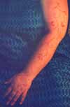 Arm with Free-form art